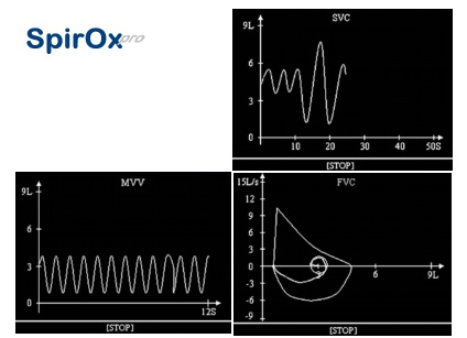 Spirometru SpirOX Pro