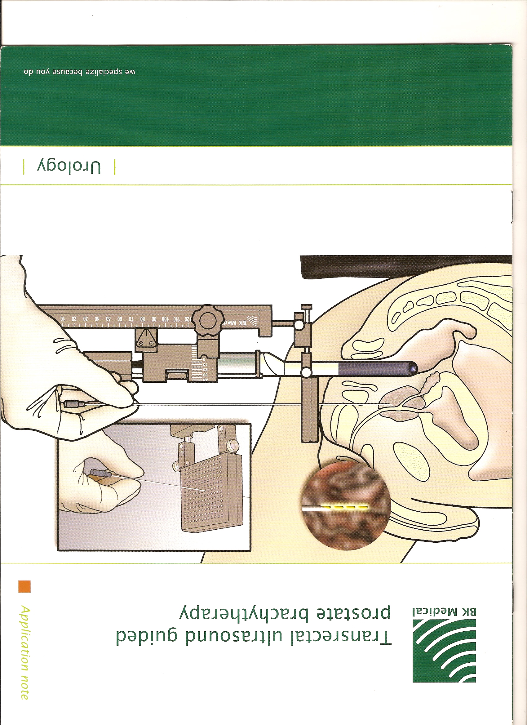 Broșură B-K Medical: brahiterapie de prostată ghidată prin ecografie transrectală